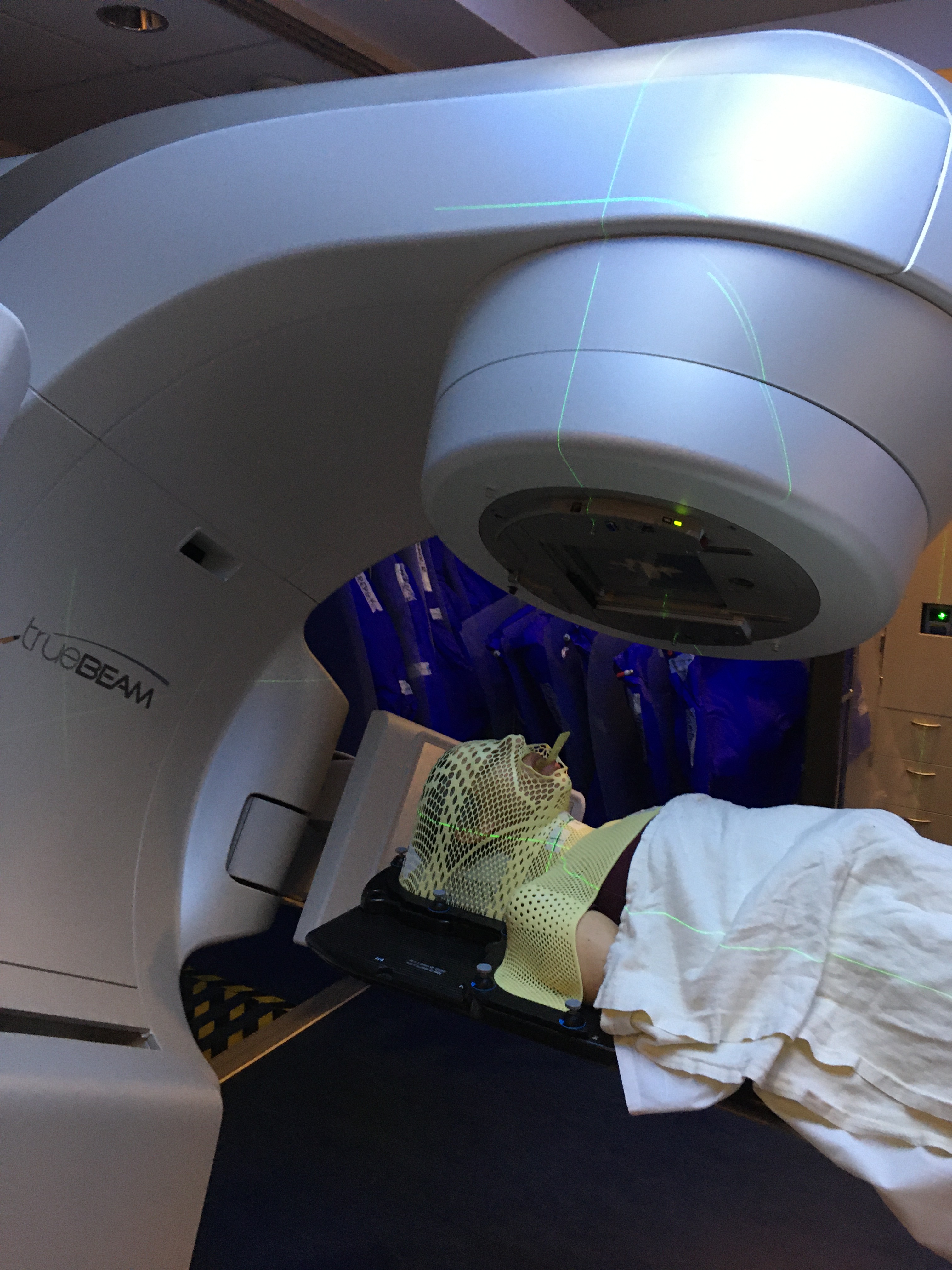 Photo of white person lying on a radiation therapy machine, with a yellow mask over their face and a blanket over their torso. You can only see a part of the person and a part of the machine.